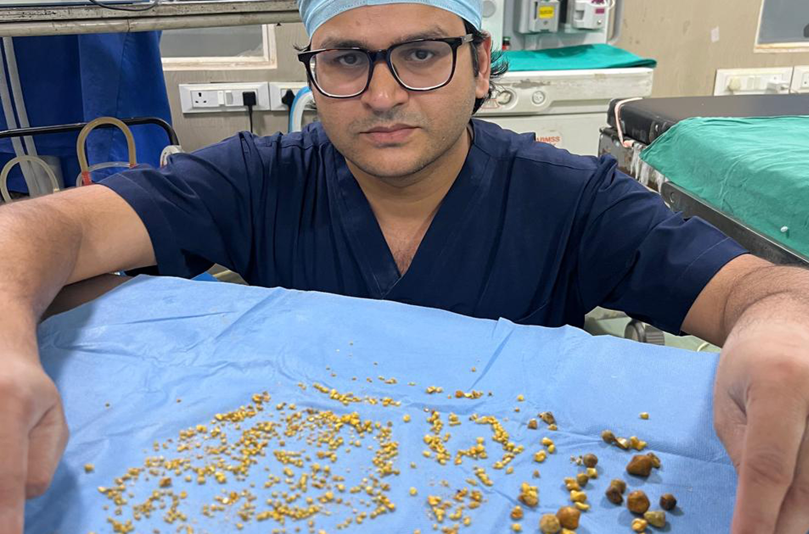 Gall bladder stone consultation
